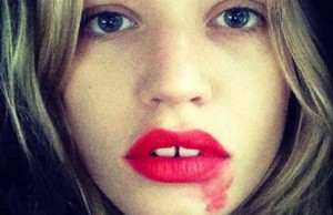Contro il tumore al collo dell’utero, #SmearForSmear