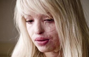 ‘Non permettete a nessuno di farvi stare zitte’, l’urlo di Katie Piper