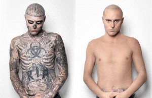 Come rimuovere i tatuaggi senza sentir dolore