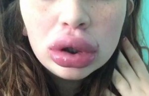 #KylieJennerChallenge: le labbra a canotto scatenano la polemica (FOTO)