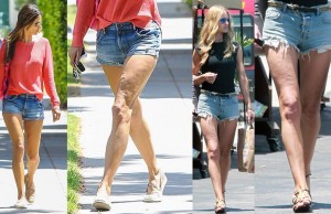 Anche le star hanno la cellulite (FOTO)