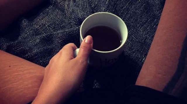 #thighreading, le smagliature non sono un problema (FOTO)