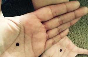 Black Dot Campaign, un punto nero per denunciare la violenza (FOTO)