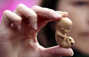 #repealthe8th: la campagna irlandese pro aborto