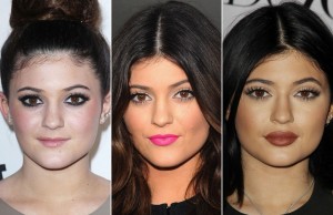 Chirurgia: labbra sfigurate dal silicone