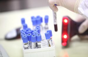 Un esame del sangue per guarire dalla depressione