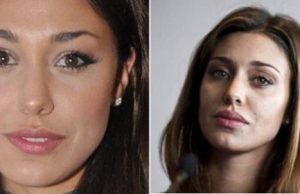 Belen e la chirurgia plastica: smetto quando voglio Belen e la chirurgia plastica